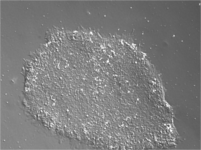 Colony of ESCs grown in NutriStem